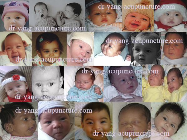 acupuncture infertility babies nyc